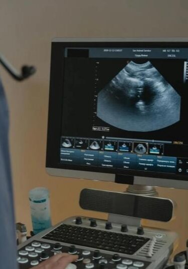 Final Lune Miscarriage Clinic Patient Experience.pptx (2) Final Lune Miscarriage Clinic Patient Experience.pptx (2)